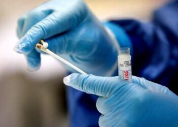 Confirman el primer caso de flurona en el país, la infección de Covid-19 y gripe