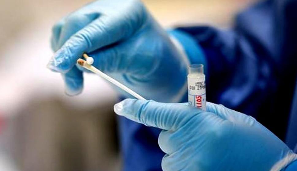 Confirman el primer caso de flurona en el país, la infección de Covid-19 y gripe