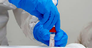 Confirmaron el primer caso de Gripe Aviar en Santiago del Estero