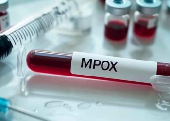 Confirmaron el primer caso autóctono de viruela del mono en Argentina